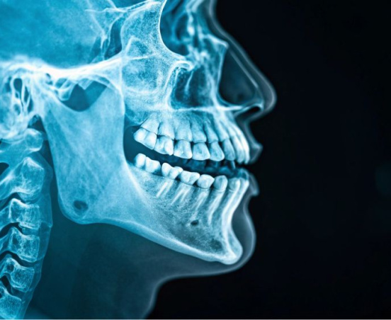 Żuchwa – budowa, funkcje i choroby