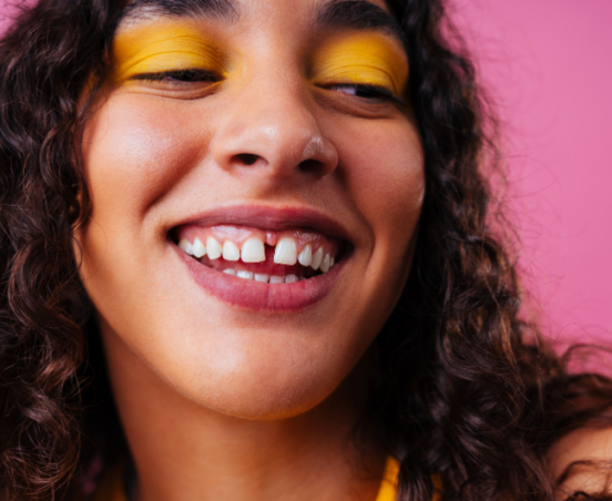 Diastema – czy wymaga leczenia?