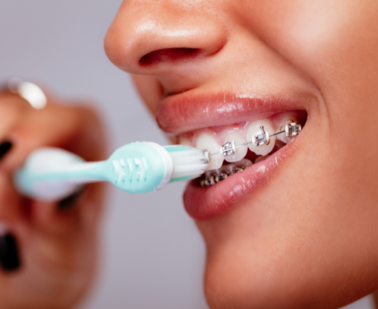 Jaka pasta do zębów przy aparacie ortodontycznym?