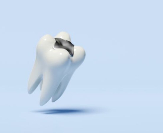 Lakowanie zębów – profilaktyka przeciwpróchnicza
