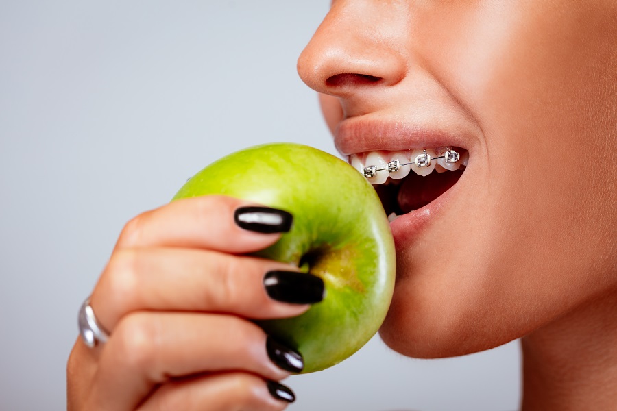 aparat ortodontyczny a dieta