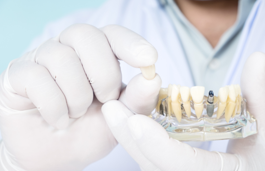 implanty do aparatu ortodontycznego