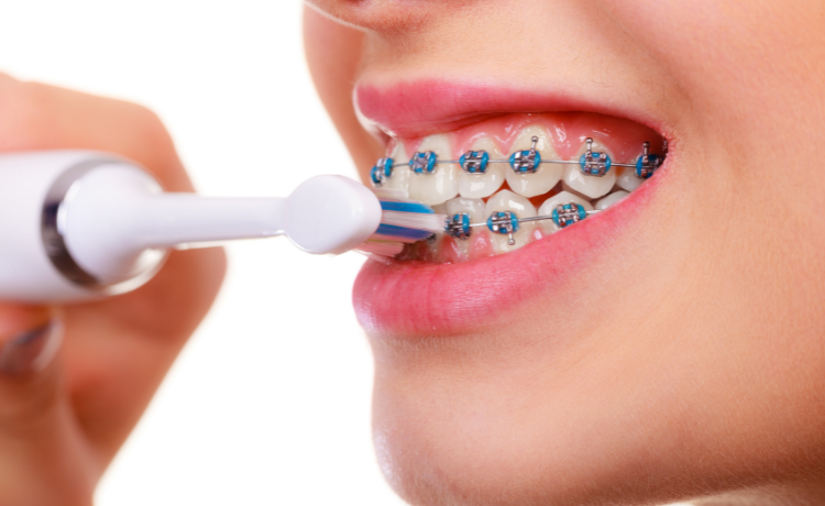 czy można myć zęby z aparatem ortodontycznym szczoteczką elektryczną?