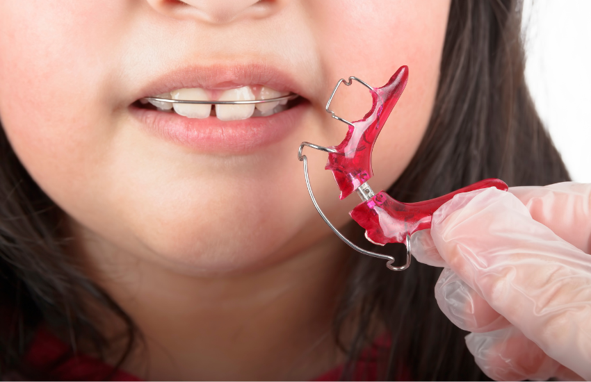 aparat ortodontyczny a zęby mleczne