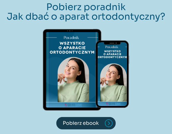 wszystko o aparacie ortodontycznym