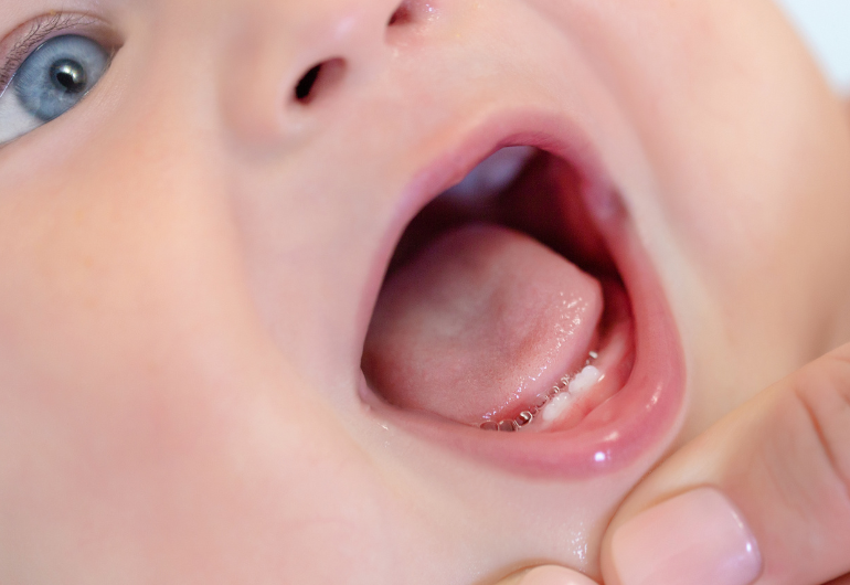 Higiena jamy ustnej niemowląt