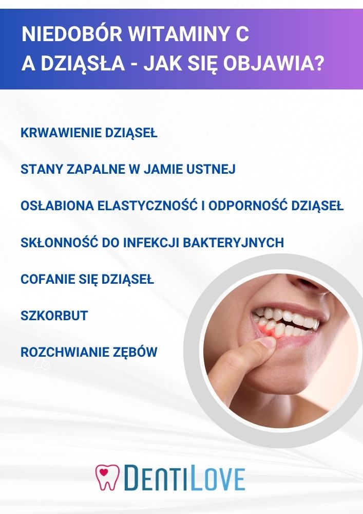 Witamina C a zdrowie dziąseł