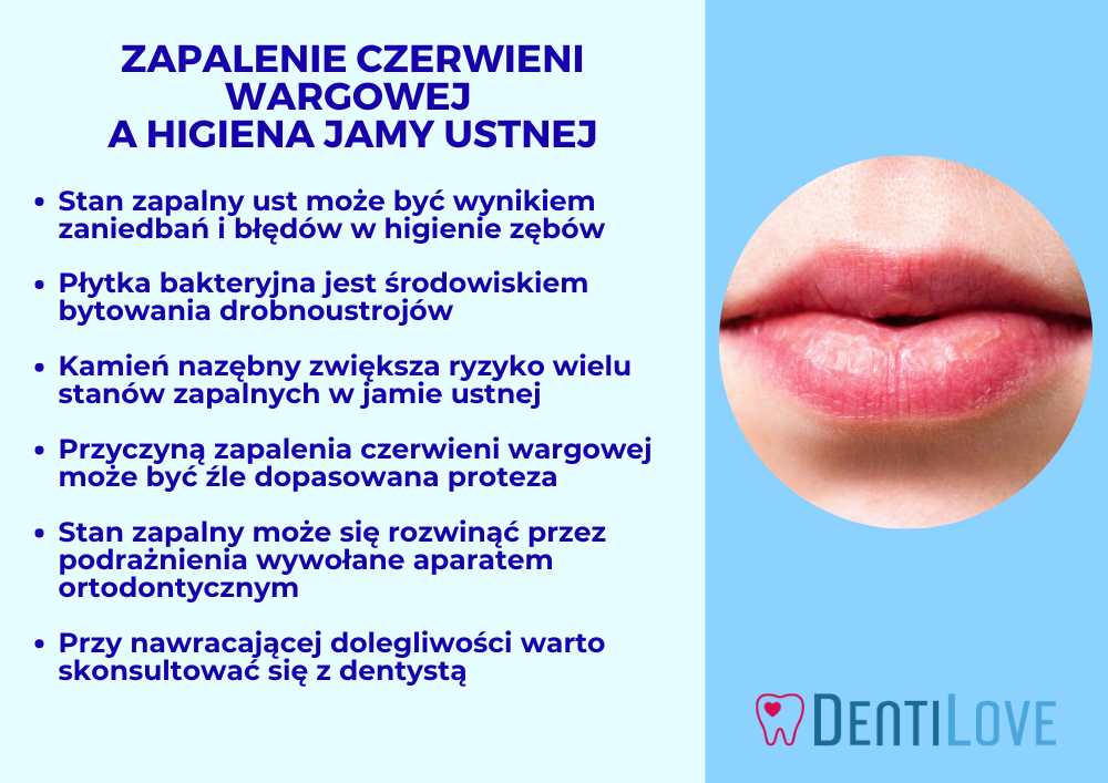 zapalenie czerwieni wargowej - infografika